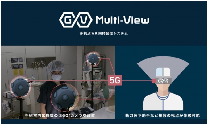 5Gによる遠隔リアルタイム医療研修VR ドコモ、J&Jら実験